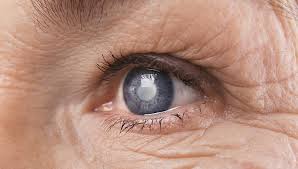 Симптомы глаукомы 